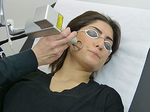 Laser Co2 fractionné Vernes Dermato-laser